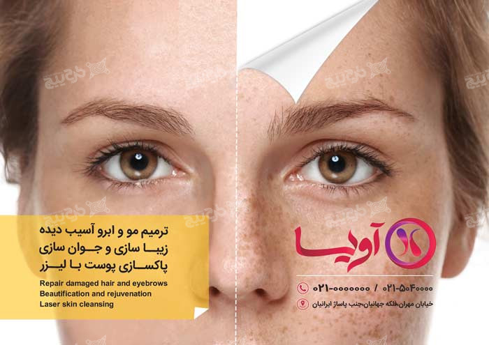 دانلود فلایر تبلیغاتی کلینیک زیبایی مو اویسا