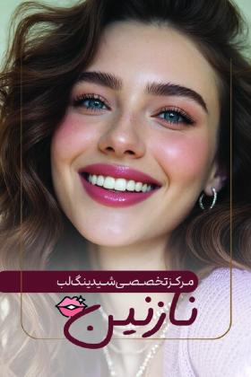 دانلود کارت ویزیت شیدینگ لب نازنین
